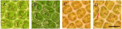 Transcriptomic Analysis Reveals the Regulation Mechanism of Sporogenesis in Ulva prolifera